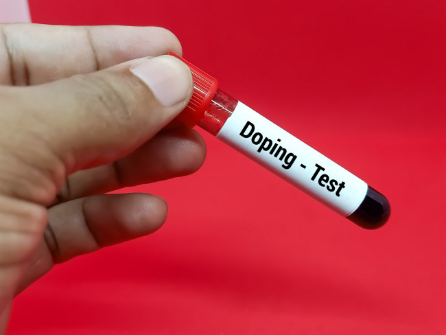 Die Antidopingtests der Tour de France führen zu Beschwerden zwischen den Fahrern und einigen Vorwürfen wegen Manipulation