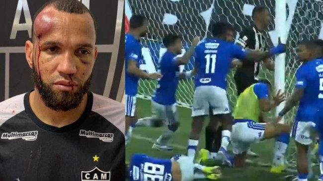 Ein brutales Spielfeldduell in Brasilien endet mit 23 Spieler, die vom Platz gestellt werden, und schweren Verletzungen