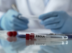 Die Ebola-Epidemie k&ouml;nnte ein Jahr andauern, prognostiziert das Rote Kreuz