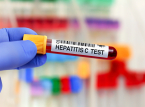 England ist auf dem besten Weg, eines der ersten L&auml;nder zu werden, in denen Hepatitis C ausgerottet wird
